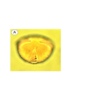 p-oacute-len-de-kiwi.jpg